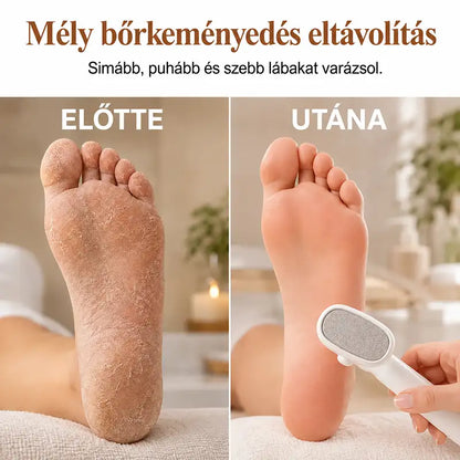 Egy lépésben működő bőrkeményedés-eltávolító